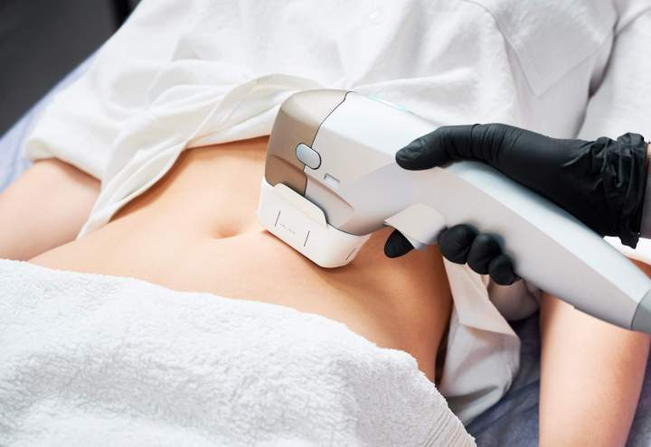 Laser Hair Removal Gatineau